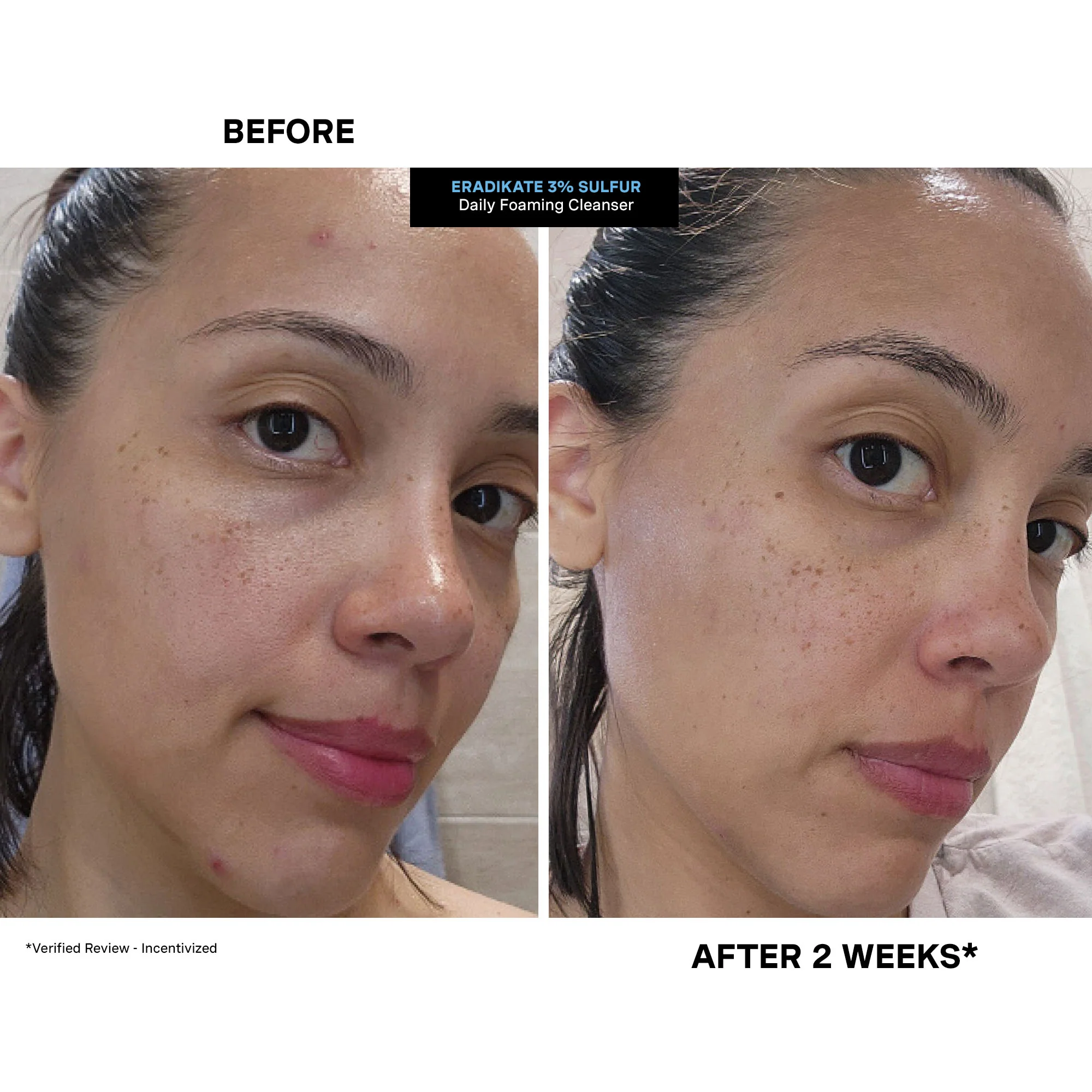 EradiKate™ Daily Foaming Cleanser - Image 4