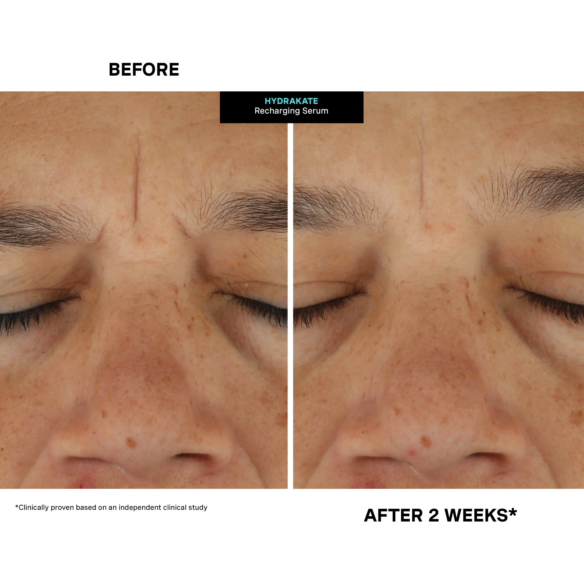 HydraKate™ Recharging Serum - Image 4