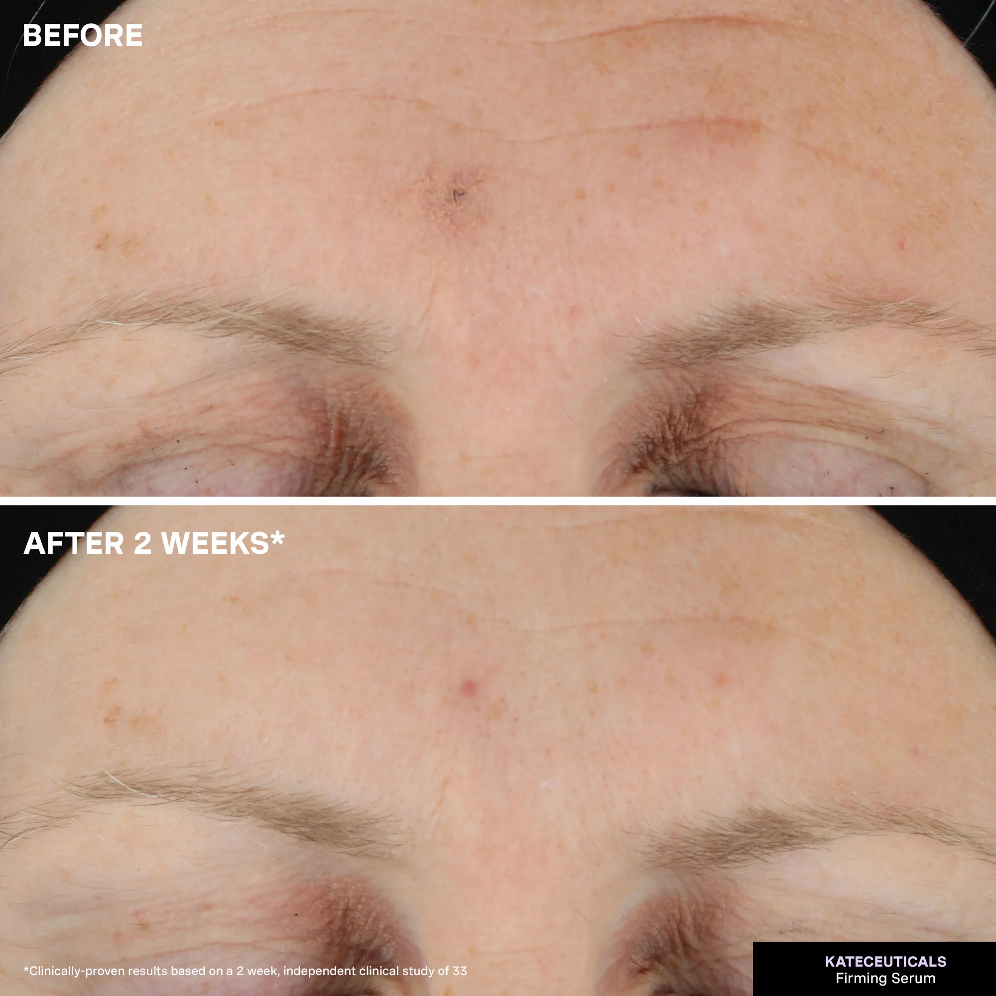 KateCeuticals™ Firming Serum - Image 5