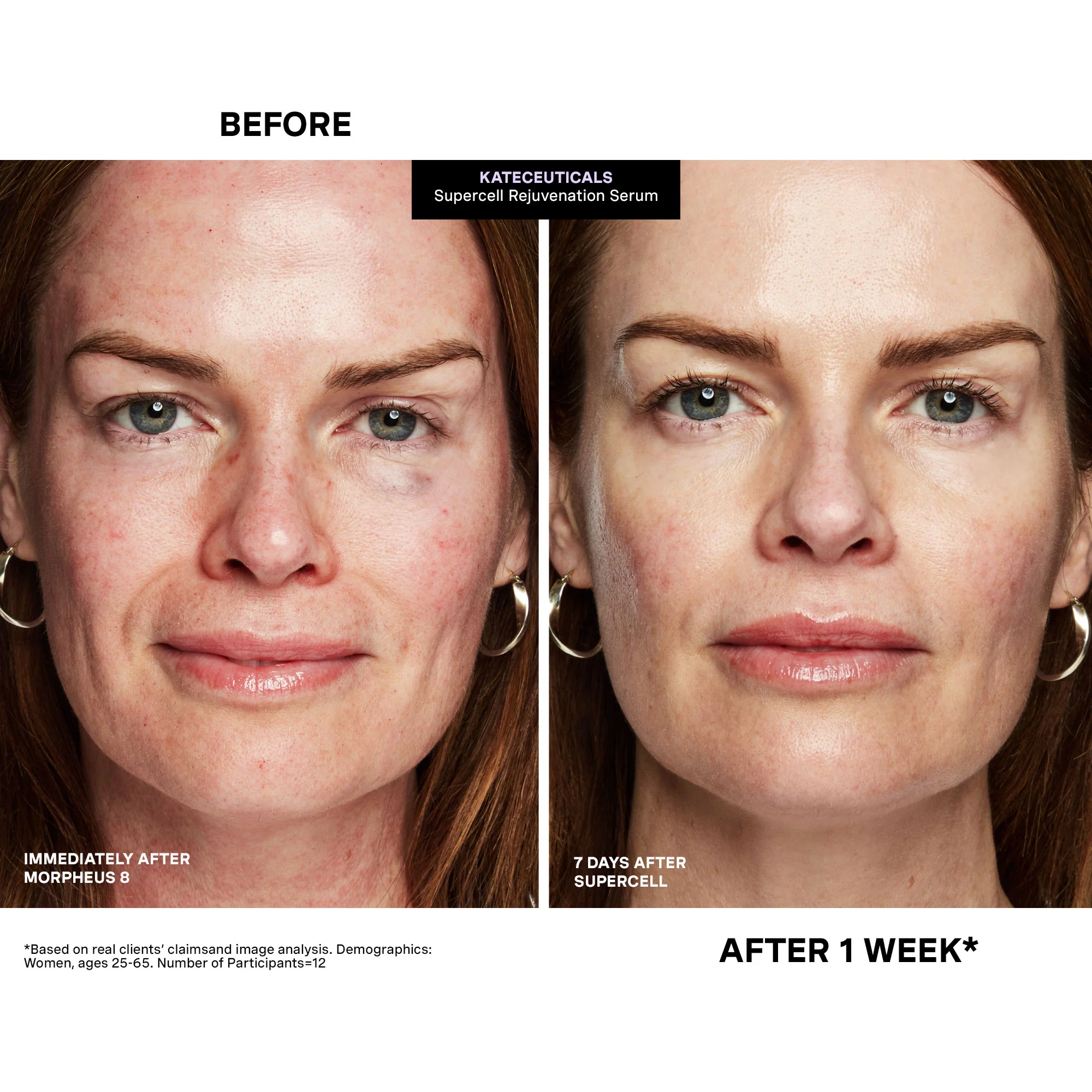 KateCeuticals SuperCell Rejuvenation Serum - Image 12