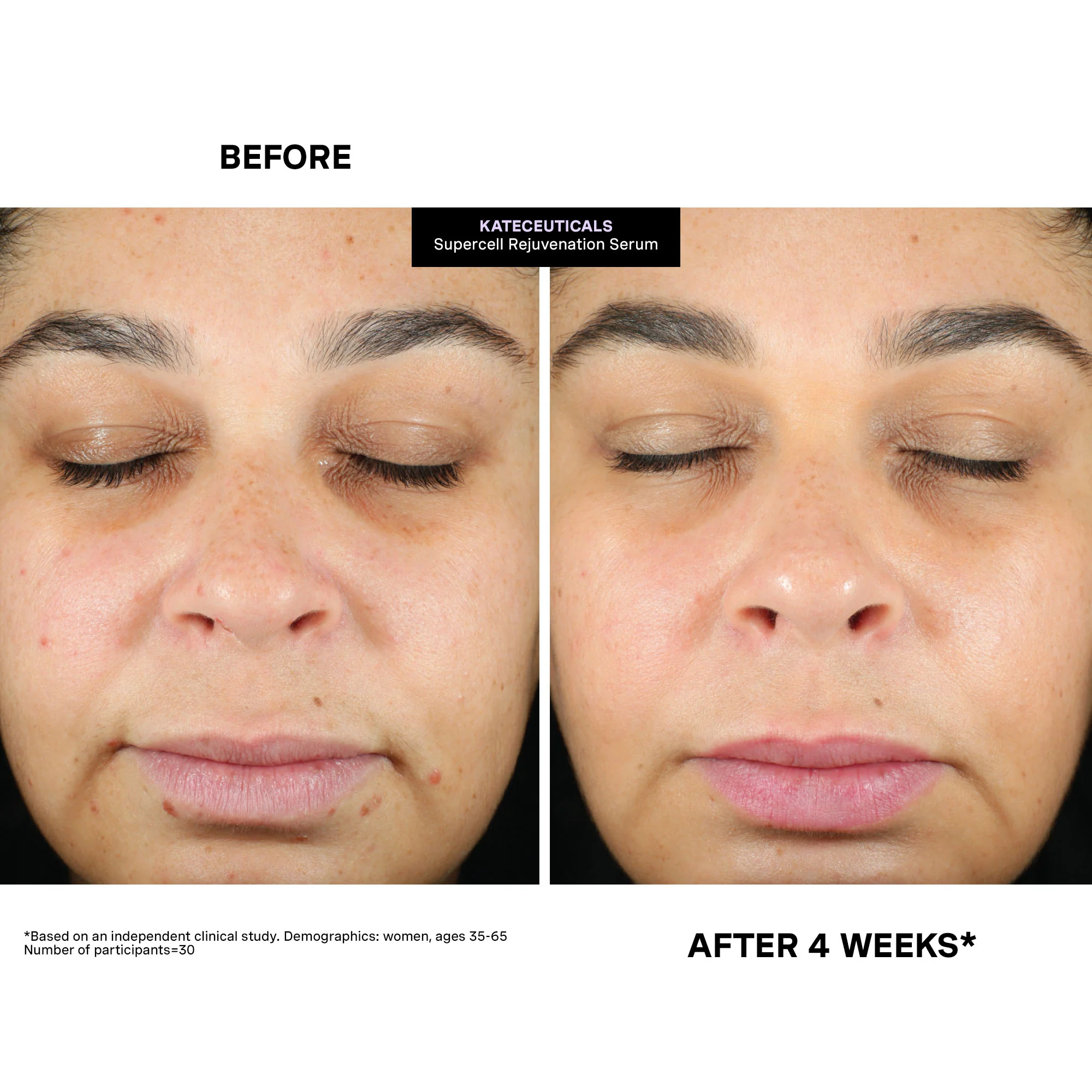 KateCeuticals SuperCell Rejuvenation Serum - Image 4