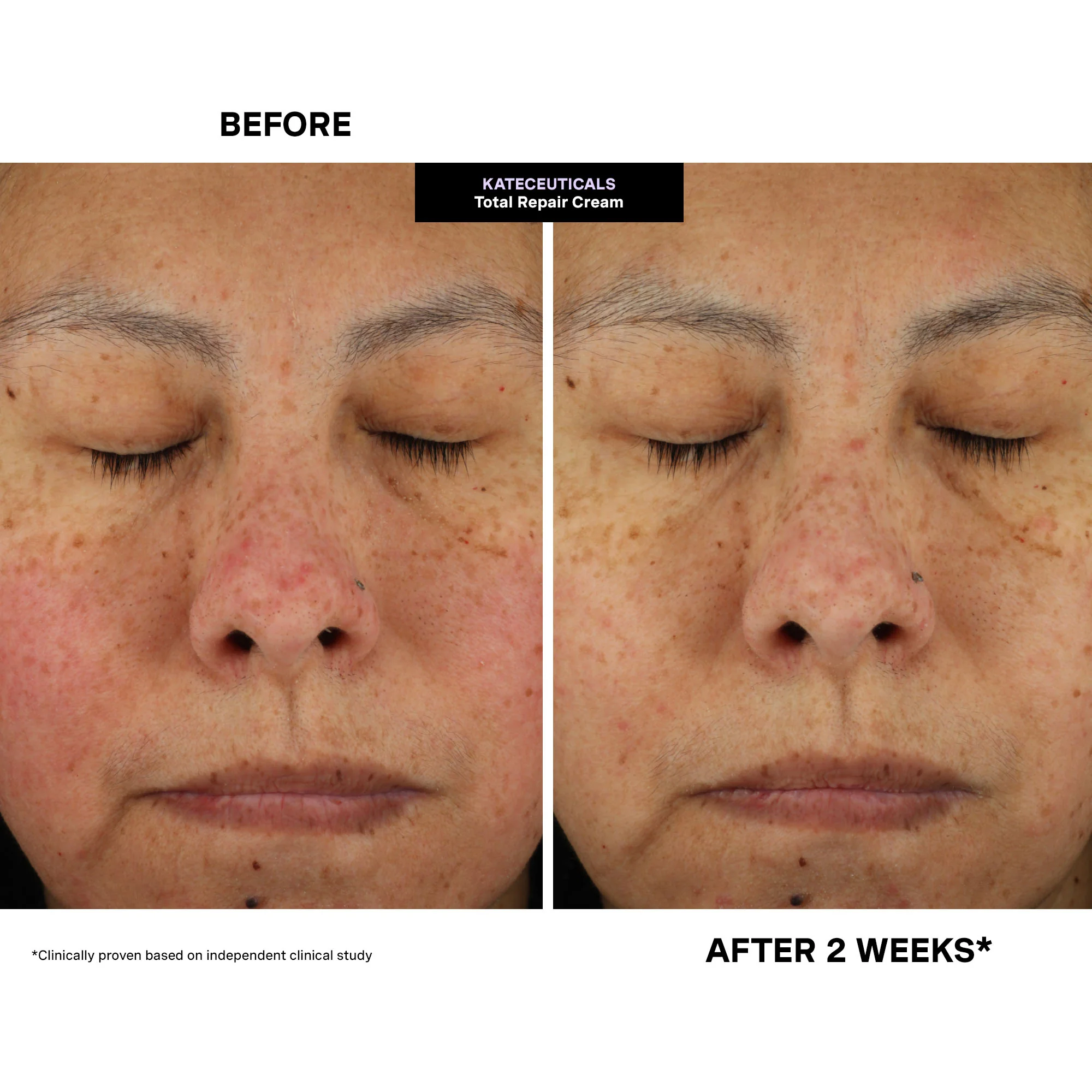 Kateceuticals™ Total Repair Cream - Image 4