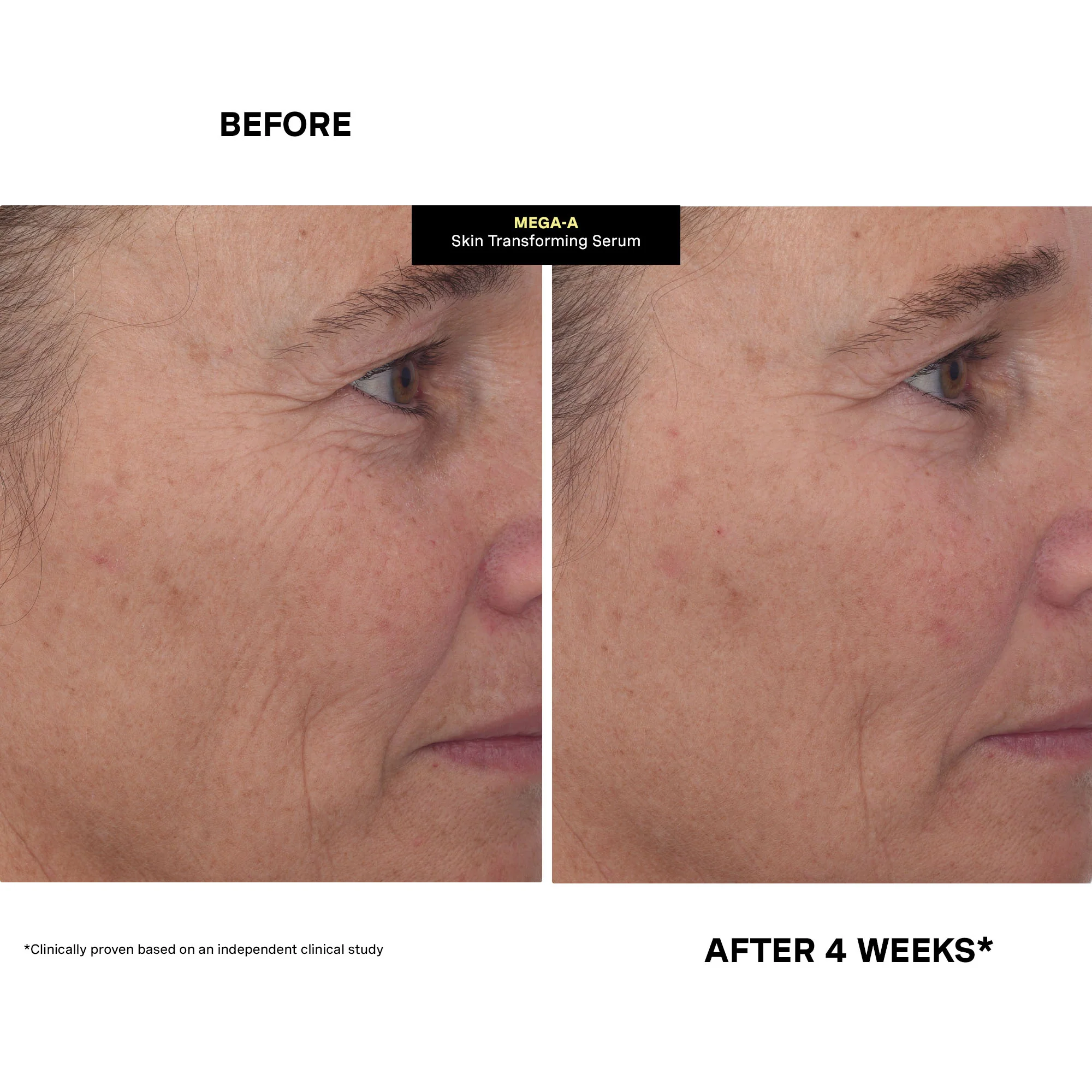 MEGA-A Skin Transforming Serum - Image 11