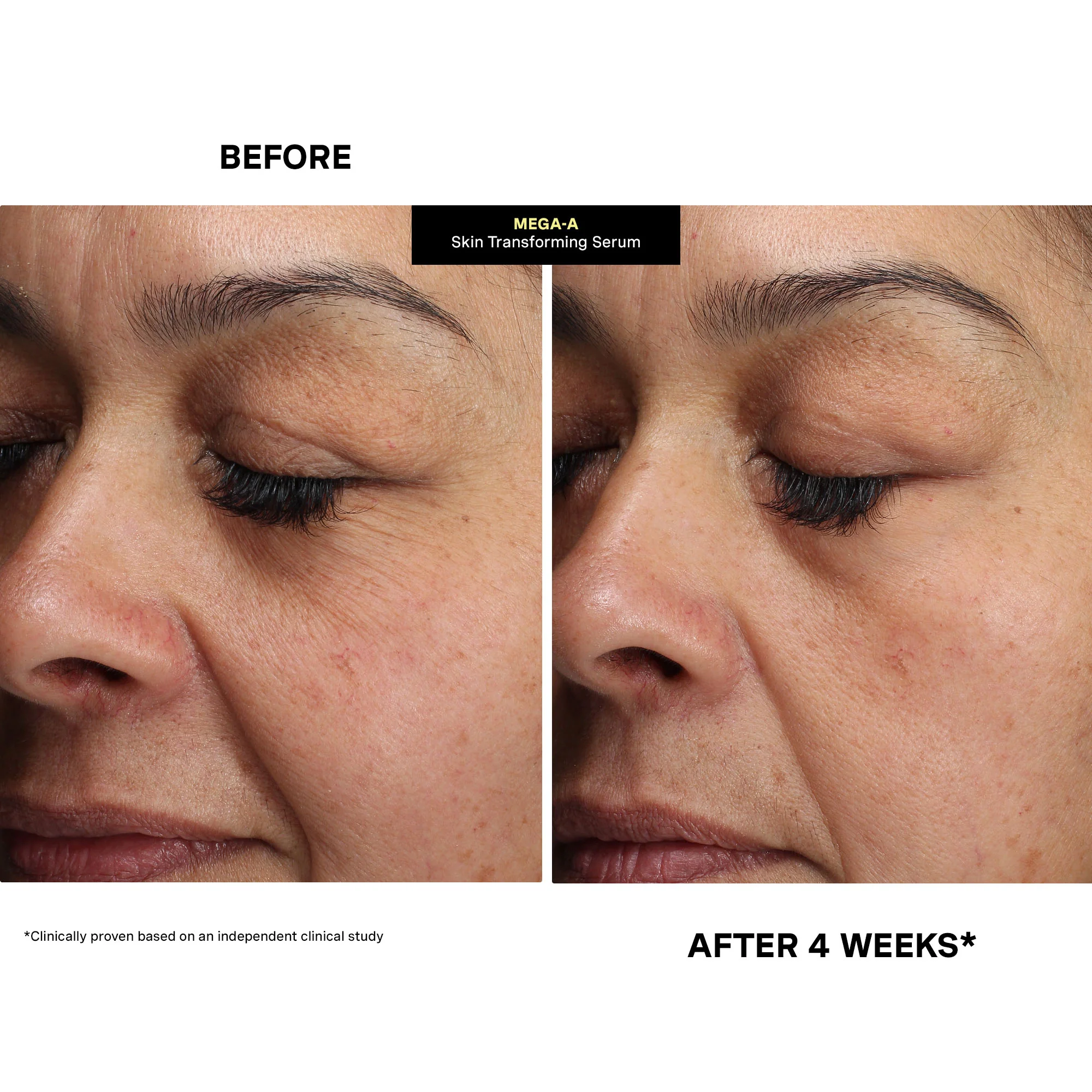 MEGA-A Skin Transforming Serum - Image 4