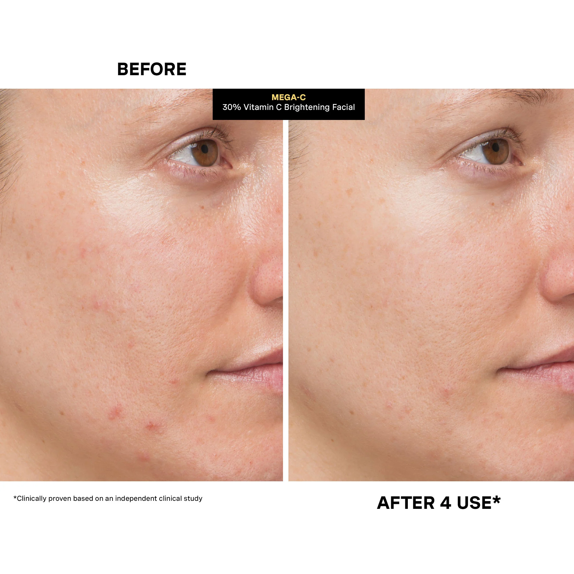 MEGA-C™ 30% Vitamin C Brightening Facial - Image 11