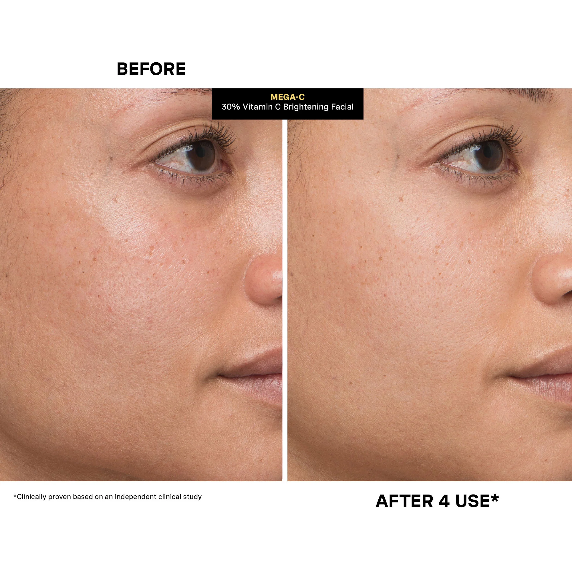 MEGA-C™ 30% Vitamin C Brightening Facial - Image 4