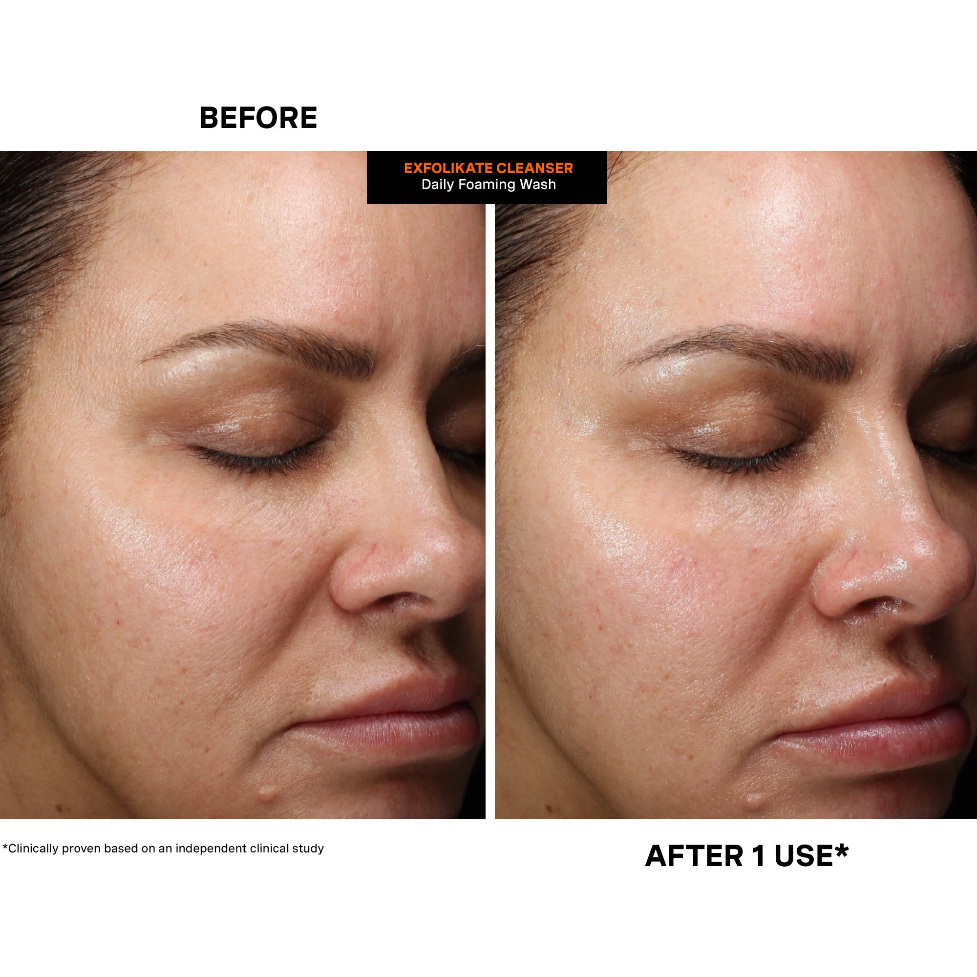 ExfoliKate® Cleanser Daily Foaming Wash - Image 11