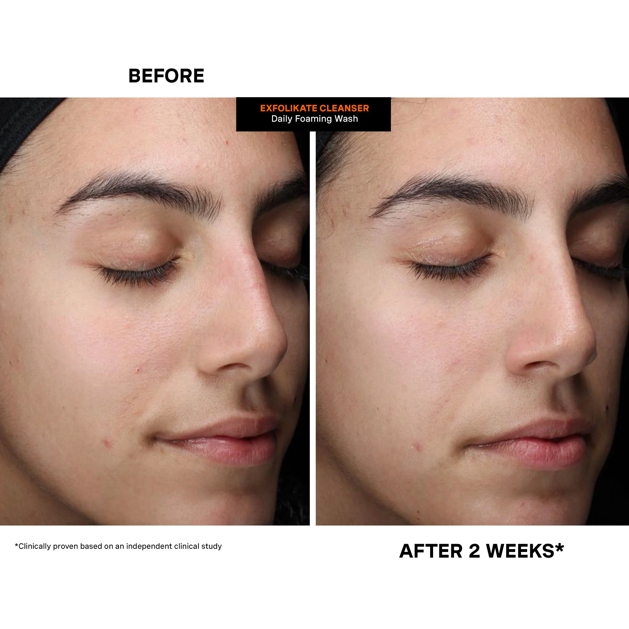 ExfoliKate® Cleanser Daily Foaming Wash - Image 4